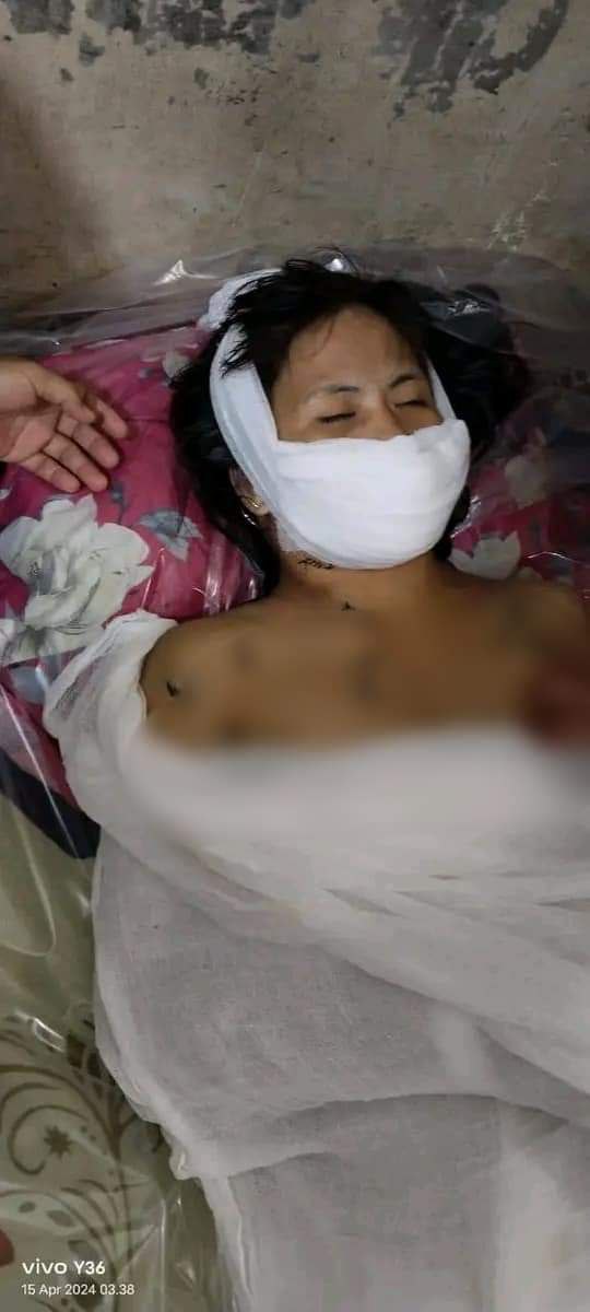 Suami Tega Menghabisi Istri nya Sendiri