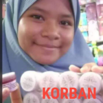 Ayah di Ternate Tega Bakar Anak Kandungnya Sendiri Karena Keluar Rumah Tidak Pamit!